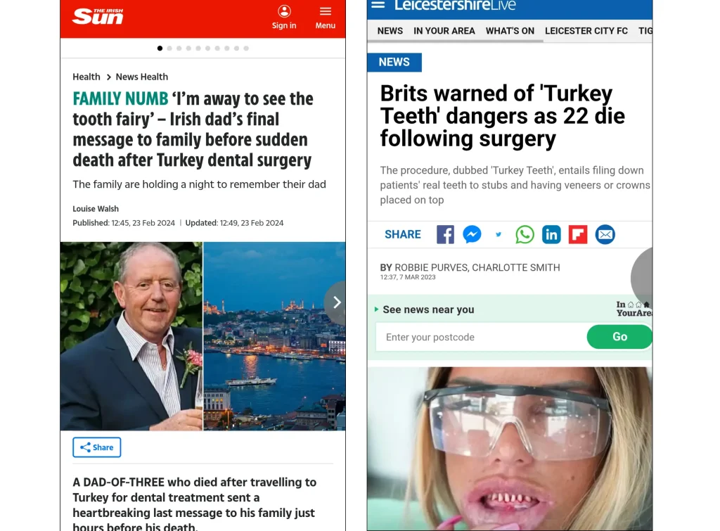 Risiko ved tandimplantater i Tyrkiet – billigt kan ende med alvorlige komplikationer