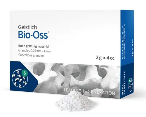 Benersättningsmaterial vid tandimplantat