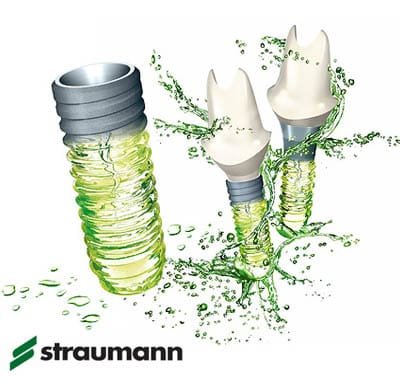 Direkte implantatindsættelse ved tandudtrækning – Hurtigere og mere skånsom behandling