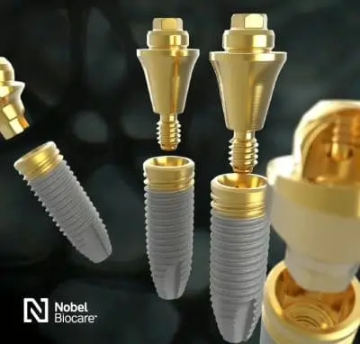 Tandimplantat boka gratis konsultation för tandimplantat i Malmö