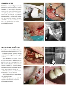 Patrik Keshishian specialist i käkkirurgi Malmö