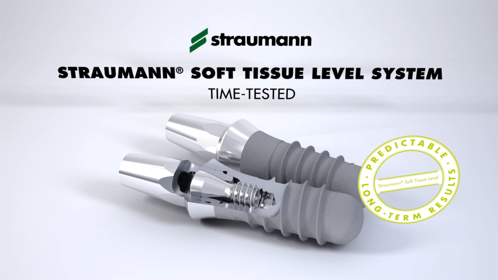 Immediate Tooth Extraction and Implant Placement – Faster, Predictable, and Aesthetic Tooth Replacement